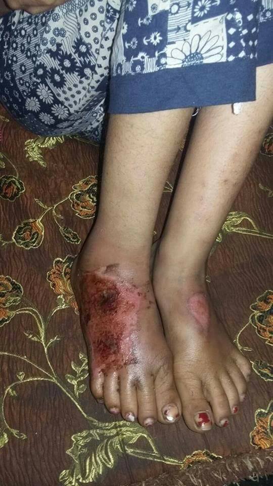 باالصور فاطمة ضحية تعذيب”مرات الأب”.